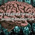 Менінгіома головного мозку лікування без операції і видалення менінгіоми, прогноз життя (операції) Менінгіома головного мозку лікування без операції і видалення менінгіоми, прогноз життя