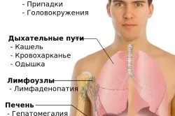 Метастазування при раку шлунка (рак) Метастазування при раку шлунка
