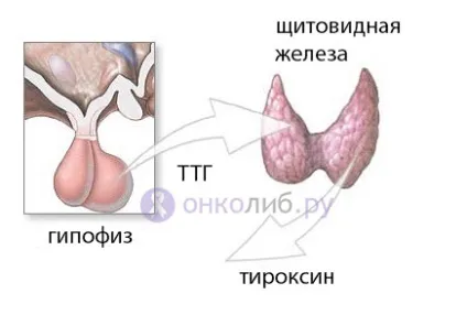 Аденома щитовидної залози, фолікулярна пухлина, токсична (аденома) Аденома щитовидної залози, фолікулярна пухлина, токсична