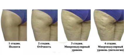 Антицелюлітний скраб для тіла з кави в домашніх умовах (тіла) Антицелюлітний скраб для тіла з кави в домашніх умовах