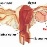 Вагітність і кіста яєчника - скальпель - медичний інформаційно-освітній портал (яєчника) Вагітність і кіста яєчника - скальпель - медичний інформаційно-освітній портал
