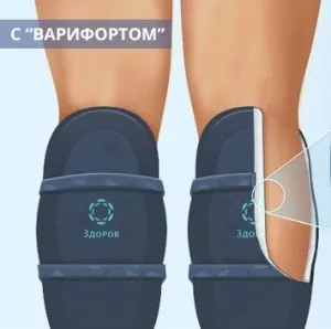 Ботфорти від варикозу плюси і мінуси (варикозу) Ботфорти від варикозу плюси і мінуси
