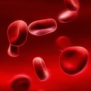 Хвороба макроглобулінемія Вальденстрема симптоми, тривалість життя і лікування (життя) Хвороба макроглобулінемія Вальденстрема симптоми, тривалість життя і лікування