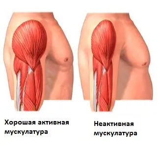 Болить рука від плеча до кисті - можливі причини і захворювання (плеча) Болить рука від плеча до кисті - можливі причини і захворювання