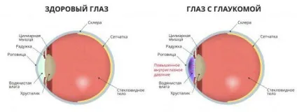 Біль в очах при русі очного яблука причини і лікування в очницях, при натисканні, (очного) Біль в очах при русі очного яблука причини і лікування в очницях, при натисканні,