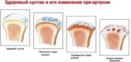 Болить рука від плеча до кисті - можливі причини і захворювання (кисті) Болить рука від плеча до кисті - можливі причини і захворювання
