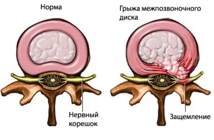 Болить рука від плеча до кисті - можливі причини і захворювання (болить) Болить рука від плеча до кисті - можливі причини і захворювання