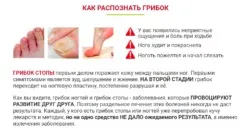 Чого дуже боїться грибок нігтів народні способи лікування (лікування) Чого дуже боїться грибок нігтів народні способи лікування
