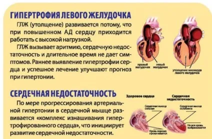 Чим небезпечний високий тиск і гіпертонія (небезпечно високий тиск) Чим небезпечний високий тиск і гіпертонія