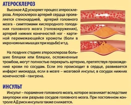 Чим небезпечний високий тиск і гіпертонія (небезпечно високий тиск) Чим небезпечний високий тиск і гіпертонія