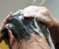 Дерматит себорейний на тілі у дорослих - що це за захворювання (дерматит) Дерматит себорейний на тілі у дорослих - що це за захворювання