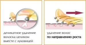 Депіляція зони бікіні в домашніх умовах воском, відео (бікіні) Депіляція зони бікіні в домашніх умовах воском, відео