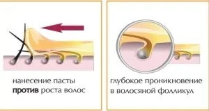 Депіляція зони бікіні в домашніх умовах воском, відео (домашніх) Депіляція зони бікіні в домашніх умовах воском, відео