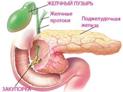 Дієта при застої жовчі в жовчному міхурі лікувальне харчування, меню, рецепти (дієта) Дієта при застої жовчі в жовчному міхурі лікувальне харчування, меню, рецепти