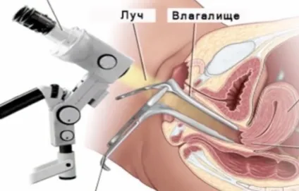 Діагностика міоми матки