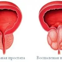 Фіалка польова і фіалка триколірна опис, властивості, рецепти - скальпель - медичний (польова) Фіалка польова і фіалка триколірна опис, властивості, рецепти - скальпель - медичний