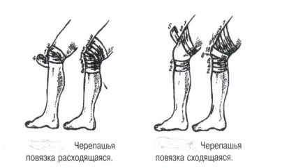 Яка фіксує пов'язка або еластичний бинт на коліно як правильно накласти при травмі і розтягуванні