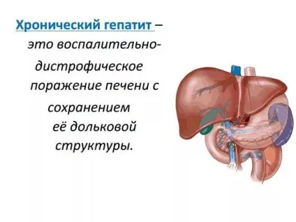 Фіброз нирки і що це таке помірний периметр фіброзу (фіброзу) Фіброз нирки і що це таке помірний периметр фіброзу