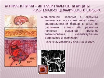 Фенілкетонурія причини, форми, симптоми, діагностика, лікування (причини) Фенілкетонурія причини, форми, симптоми, діагностика, лікування