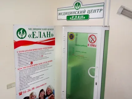 Герметик для зубів - користь чи шкода