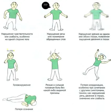 Геморагічний інсульт симптоми і початкові ознаки (симптоми) Геморагічний інсульт симптоми і початкові ознаки