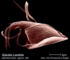 Глисти у собаки основні симптоми і лікування (собаки) Глисти у собаки основні симптоми і лікування
