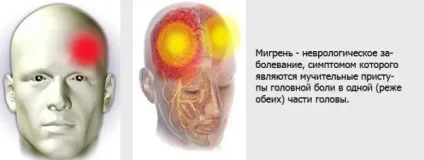 Очні краплі від втоми і напруги очей від комп'ютера для зняття список і назви (напруги) Очні краплі від втоми і напруги очей від комп'ютера для зняття список і назви
