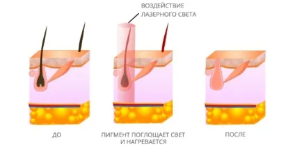 Глибоке бікіні в домашніх умовах самостійно способи (самостійно) Глибоке бікіні в домашніх умовах самостійно способи