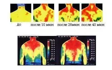 Нефрит лікувальні властивості і цілительство (лікувальні) Нефрит лікувальні властивості і цілительство