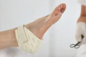 Як лікувати пролежні на п'ятах методи і варіації (лікувати) Як лікувати пролежні на п'ятах методи і варіації