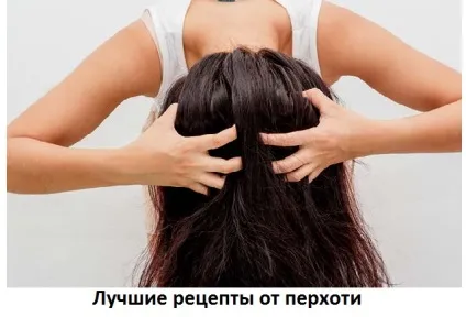 Як лікувати лупу на голові в домашніх умовах за 1 день, сайт про методи лікування докторів (лікування болиголов) Як лікувати лупу на голові в домашніх умовах за 1 день, сайт про методи лікування докторів