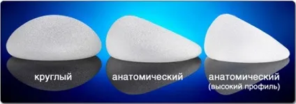 Чи потрібно міняти імпланти молочних залоз і що може бути причиною (міняти) Чи потрібно міняти імпланти молочних залоз і що може бути причиною