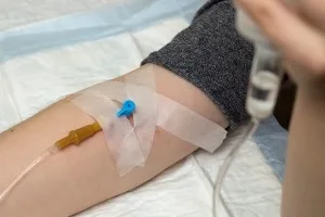 Як ставити крапельницю в домашніх умовах правильно (крапельницю) Як ставити крапельницю в домашніх умовах правильно