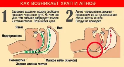 Як видалити одного з Привату (видалити одного Привату) Як видалити одного з Привату