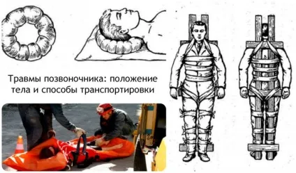 Надання першої допомоги при різних травмах відео (перша допомога) Надання першої допомоги при різних травмах відео