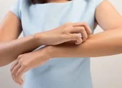 шкірні висипання