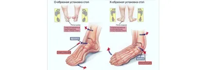 Купити устілки Бикова ортопедичні супинированні 36-38 (устілки Бикова купити + в москві) Купити устілки Бикова ортопедичні супинированні 36-38
