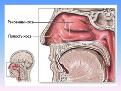 Кт в діагностиці патологій придаткових пазух носа (діагностиці) Кт в діагностиці патологій придаткових пазух носа