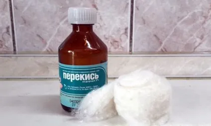 Лікування герпесу перекисом водню опис процедури (перекисом) Лікування герпесу перекисом водню опис процедури