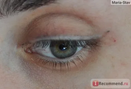 Лазерне видалення татуажу - «чи то з роками розумнішаємо, то чи стаємо гарніше, але у мене була своя (видалення) Лазерне видалення татуажу - «чи то з роками розумнішаємо, то чи стаємо гарніше, але у мене була своя