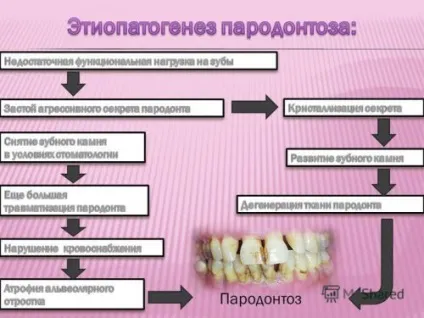 Лікування пародонтозу народними засобами ефірні масла, прополіс (пародонтозу) Лікування пародонтозу народними засобами ефірні масла, прополіс