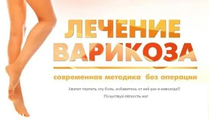 Кращі народні рецепти від варикозу - найефективніші народні засоби (народні) Кращі народні рецепти від варикозу - найефективніші народні засоби