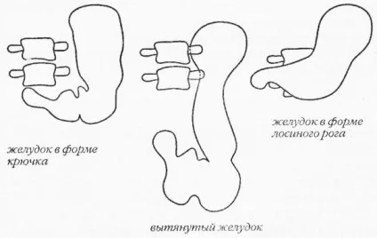 Відділи шлунка людини