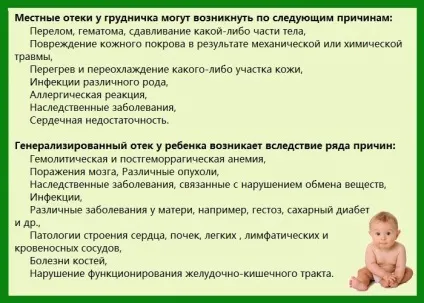 Набряки у грудничка