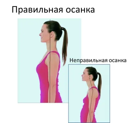 Остеохондроз симптоми, методи діагностики і лікування остеохондрозу (прояви остеохондрозу) Остеохондроз симптоми, методи діагностики і лікування остеохондрозу