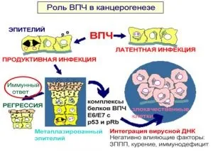 Мазь від кондилом коли застосовувати і яку краще вибрати (мазь) Мазь від кондилом коли застосовувати і яку краще вибрати