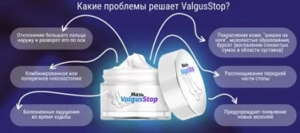 Мазь від кісточок на ногах (біологічно активні речовини) Мазь від кісточок на ногах