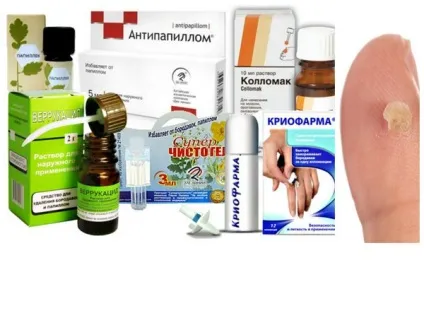 Мазь від папілом яку краще вибрати (вірус папіломи людини) Мазь від папілом яку краще вибрати