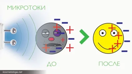 Мікроструми - омолодження з доведеною ефективністю (доведеною) Мікроструми - омолодження з доведеною ефективністю