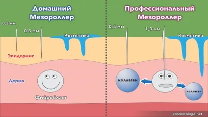 Мезороллер - в чому підступ